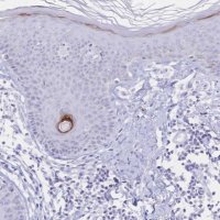 Anti-PSORS1C2 antibody produced in rabbit 