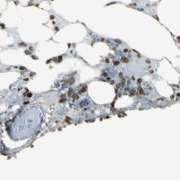 Anti-PSTPIP1 antibody produced in rabbit 