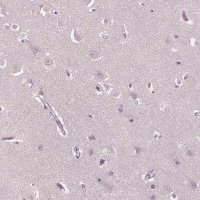 Anti-PSTPIP2 antibody produced in rabbit 