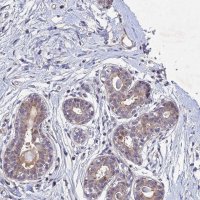 Anti-PTHLH antibody produced in rabbit 