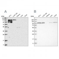 Anti-PTK2B antibody produced in rabbit 
