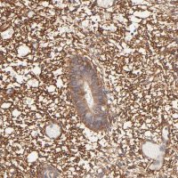 Anti-PTK7 antibody produced in rabbit 