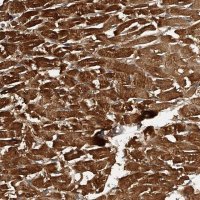 Anti-PTPRA antibody produced in rabbit HPA029412-100UL