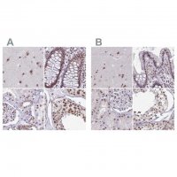 Anti-PUF60 antibody produced in rabbit 