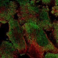 Anti-PUM1 antibody produced in rabbit 