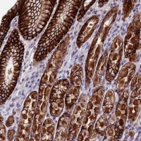 Anti-PUS10 antibody produced in rabbit 