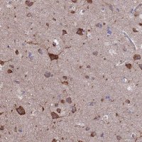 Anti-PYCR1 antibody produced in rabbit 