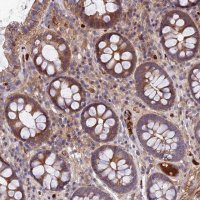 Anti-PYM1 antibody produced in rabbit 