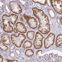 Anti-PYROXD2 antibody produced in rabbit 