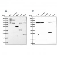 Anti-QARS antibody produced in rabbit 