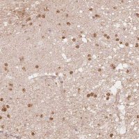 Anti-QDPR antibody produced in rabbit 