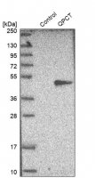 Anti-QPCT antibody produced in rabbit 