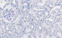 Anti-QPRTase Antibody, clone 1G22 ZooMAb Rabbit Monoclonal 