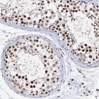 Anti-QRICH1 antibody produced in rabbit 