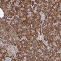 Anti-QRSL1 antibody produced in rabbit HPA029585-100UL
