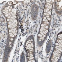 Anti-RAB21 antibody produced in rabbit 
