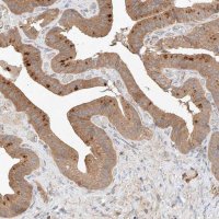 Anti-RAB23 antibody produced in rabbit 