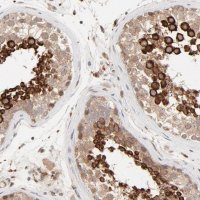 Anti-RAB5C antibody produced in rabbit 