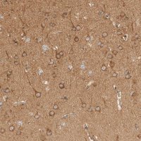 Anti-RABEP1 antibody produced in rabbit 