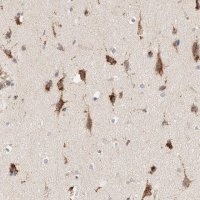 Anti-RABEPK antibody produced in rabbit 