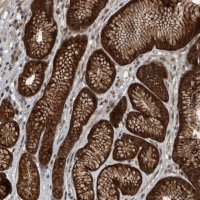 Anti-RABGGTB antibody produced in rabbit 