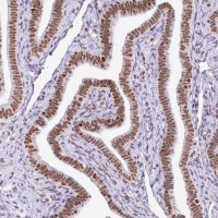 Anti-RARG antibody produced in rabbit 