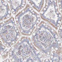 Anti-RASA2 antibody produced in rabbit 