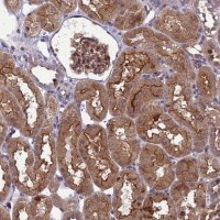 Anti-RASD1 antibody produced in rabbit 
