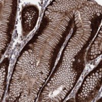Anti-RASSF3 antibody produced in rabbit 