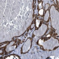 Anti-RBBP9 antibody produced in rabbit HPA015830-100UL