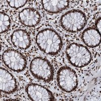 Anti-RBM26 antibody produced in rabbit 