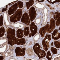 Anti-RBP5 antibody produced in rabbit 