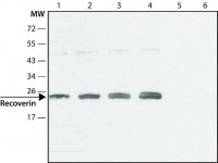 Anti-Recoverin (C-terminal) antibody produced in rabbit SAB4200309-200UL