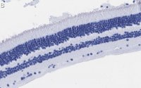 Anti-Recoverin Antibody, clone 1K10 ZooMAb Rabbit Monoclonal 
