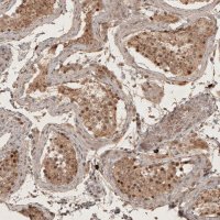 Anti-RECQL5 antibody produced in rabbit 