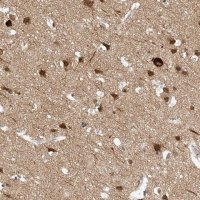 Anti-REEP2 antibody produced in rabbit 