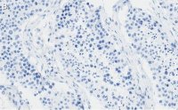 Anti-REST Antibody, clone 2E3 ZooMAb Rabbit Monoclonal 