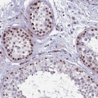Anti-RGS17 antibody produced in rabbit 