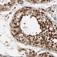 Anti-RHOJ antibody produced in rabbit 