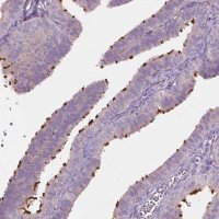 Anti-RIIAD1 antibody produced in rabbit 