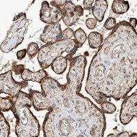 Anti-RILPL2 antibody produced in rabbit 