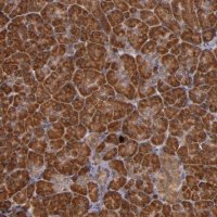 Anti-RIOK3 antibody produced in rabbit 