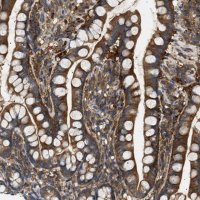 Anti-RIPK1 antibody produced in rabbit 