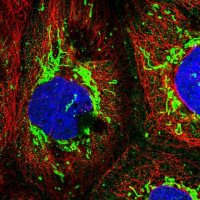 Anti-RNF138 antibody produced in rabbit 