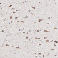 Anti-RNF213 antibody produced in rabbit 