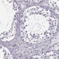 Anti-RNF32 antibody produced in rabbit 