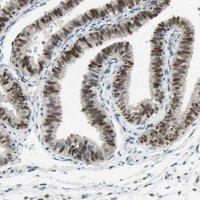 Anti-RNF43 antibody produced in rabbit 
