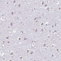 Anti-RNFT2 antibody produced in rabbit HPA064161-100UL