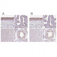 Anti-ROPN1L antibody produced in rabbit 