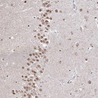 Anti-RP11-382A20.3 antibody produced in rabbit 